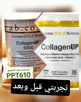 تجربتي مع الكولاجين قبل وبعد من اي هيرب Collagen Up