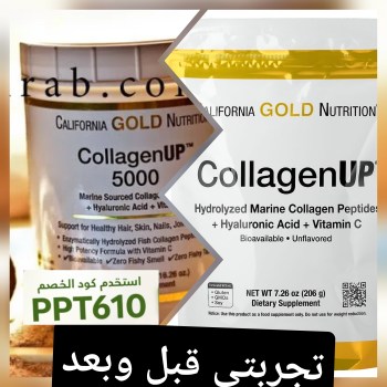 تجربتي مع الكولاجين قبل وبعد من اي هيرب Collagen Up